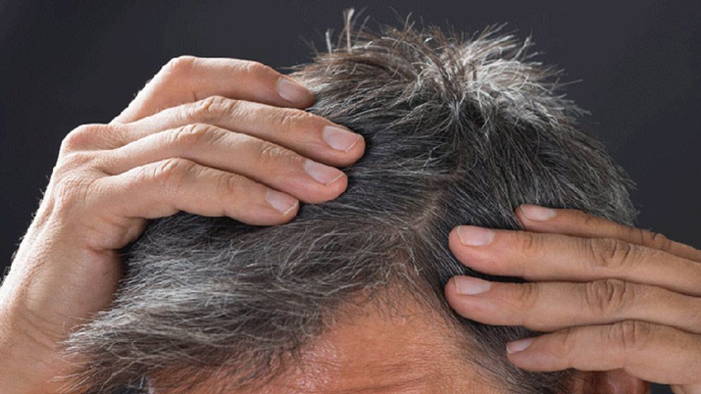 অসময়ে চুল পাকলে যা করবেন