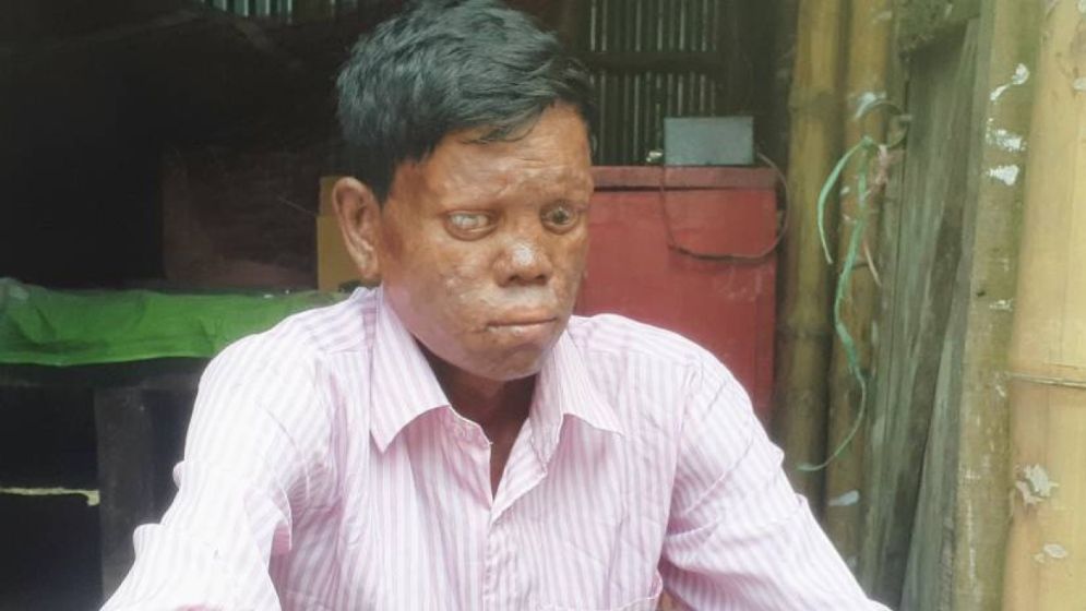 বাঁচতে চান জাহিদুল