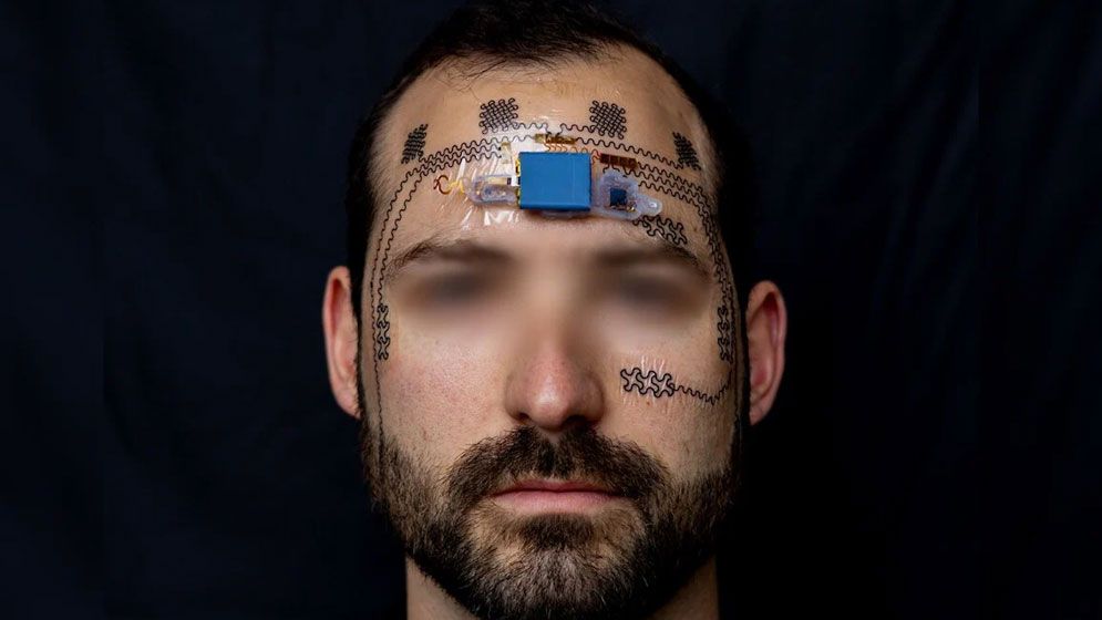 মানসিক চাপ জানাবে যন্ত্র, পরিমাণ বেশি হলে সতর্ক করবে ‘ই-ট্যাটু’!