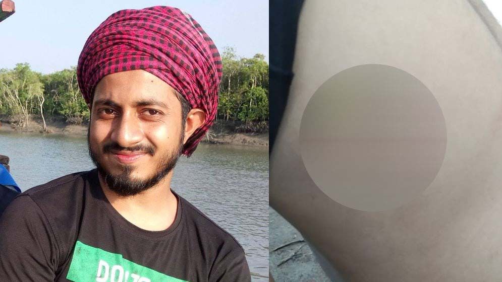 টাঙ্গাইলে সাংবাদিক হাসসান আতিকের ওপর হামলা, হাসপাতালে ভর্তি