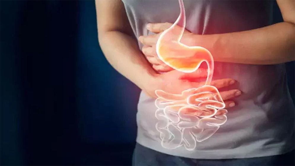 ঈদের পর হজম সমস্যায় ভুগছেন? সমাধান মিলবে যেভাবে