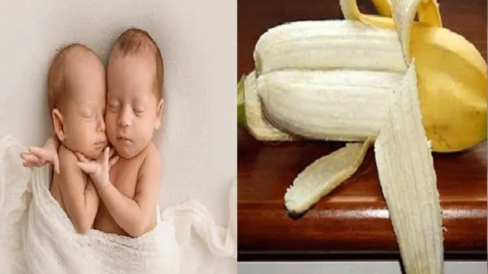 জোড়া কলা খেলে কি যমজ সন্তান হয়?