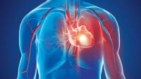 হার্টে ব্লকেজ হবে না, মৃত্যুর ঝুঁকি কমাবেন যেভাবে