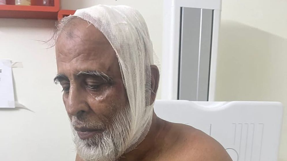 কাঙ্ক্ষিত পদ না পেয়ে কৃষক দল নেতার মাথা ফাটালেন বিএনপি নেতা