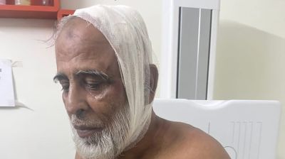 কাঙ্ক্ষিত পদ না পেয়ে কৃষক দল নেতার মাথা ফাটালেন বিএনপি নেতা