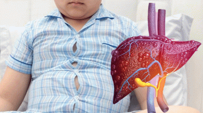 শিশুদেরও ফ্যাটি লিভার হয়