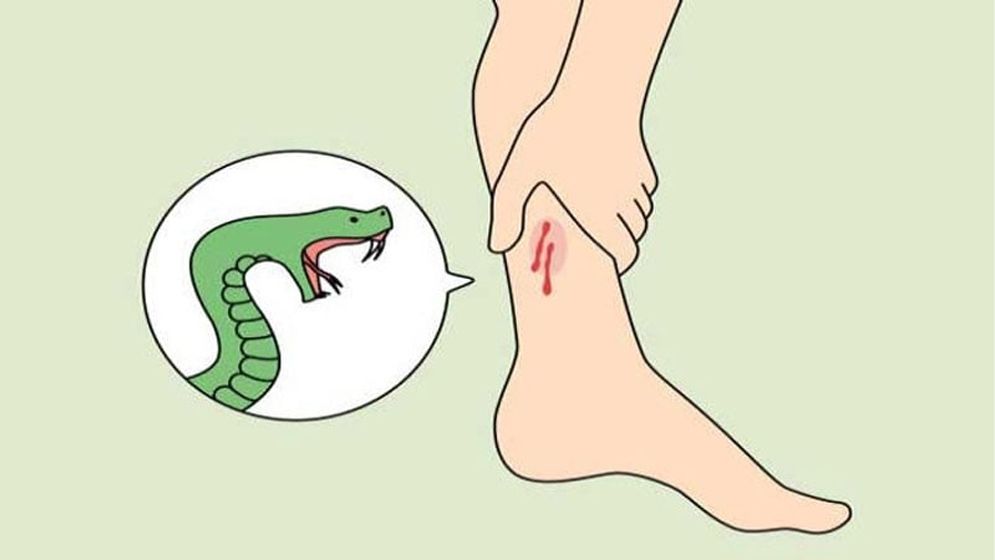 সাপে কাটলে কী করবেন? কোন ভুলগুলো একদমই করা উচিত নয়?