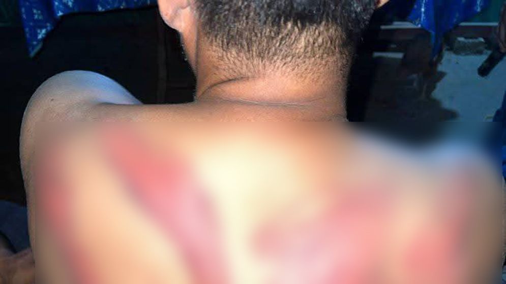 ছেলের শরীরে অপহরণকারীদের নির্যাতনের চিহ্ন দেখে বাবার মৃত্যু