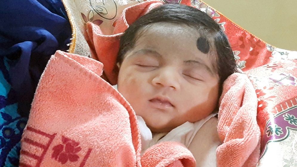 নবজাতকের জন্ডিস