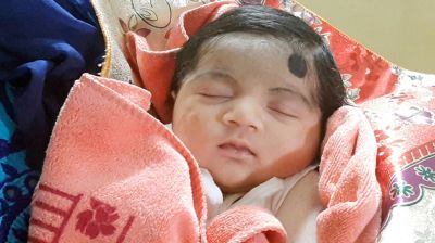 নবজাতকের জন্ডিস