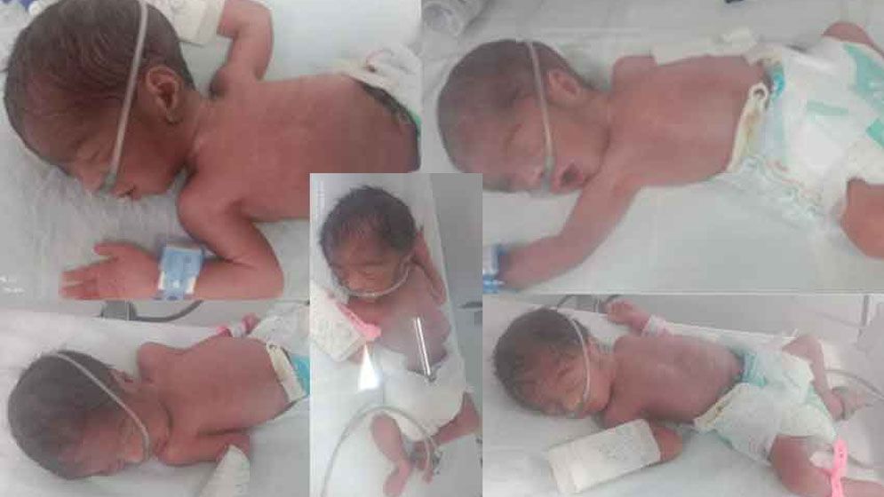 একসঙ্গে পাঁচ সন্তানের জন্ম দিলেন পাকিস্তানি নারী