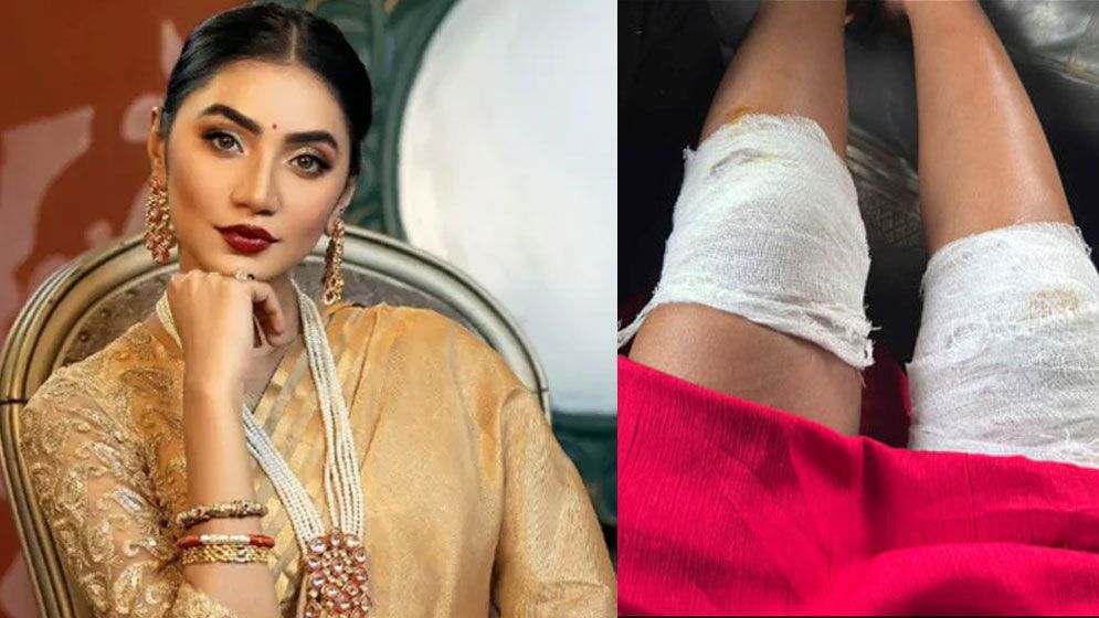 শুটিং সেটে দুর্ঘটনার শিকার অভিনেত্রী সুনেরাহ