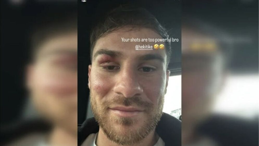 ‘ভাই, তোমার শটে তো বেশ জোর!’ আঘাত পেয়ে নতুন সতীর্থকে বললেন আর্জেন্টাইন বিশ্বজয়ী