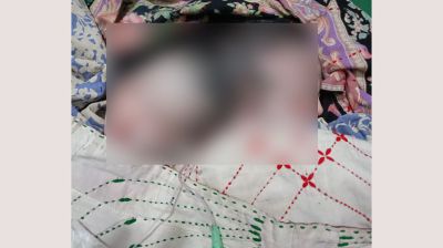 নাঙ্গলকোটে জোড়া লাগানো যমজ কন্যা জন্ম, উন্নত চিকিৎসার পরামর্শ