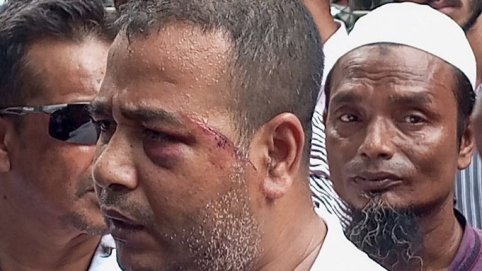 চাঁদা না পেয়ে প্রবাসীকে মারধর, বিএনপি নেতার বিরুদ্ধে মামলা