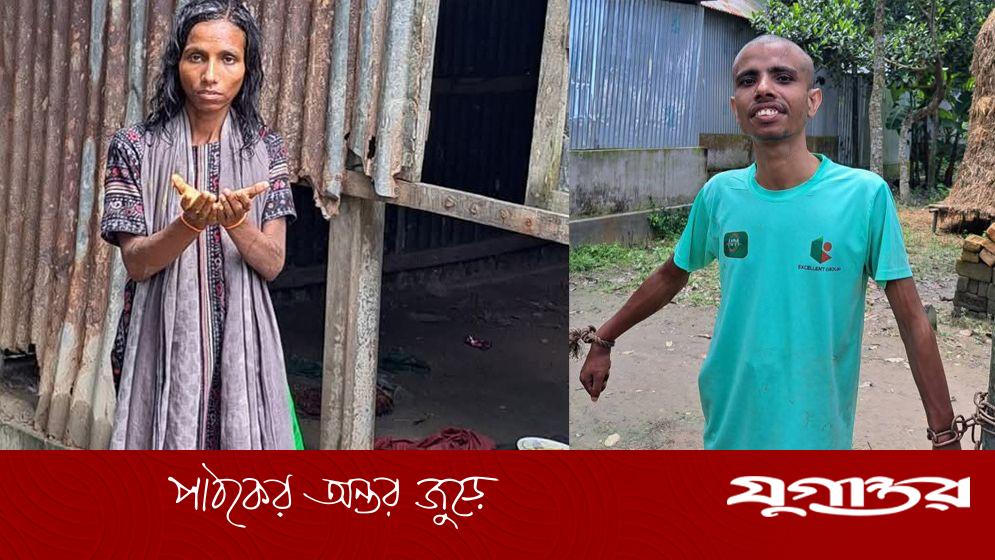 ১২ বছর ধরে ভাই-বোনের শিকলবন্দি জীবন