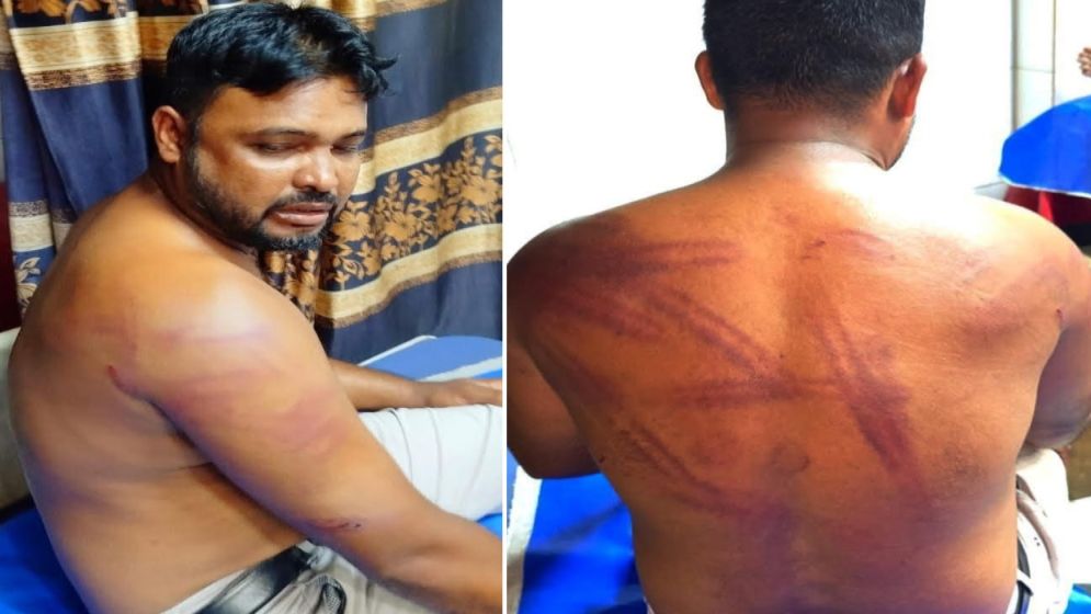 বান্দরবানে যুবদল নেতাকে অপহরণ করে মধ্যযুগীয় কায়দায় নির্যাতন