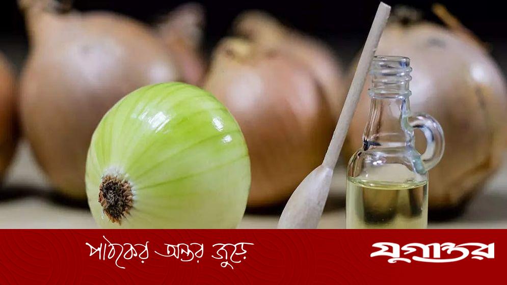 চুল পড়া রোধে পেঁয়াজের রস ব্যবহার কতটা কার্যকর?