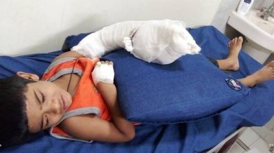 ২০ টাকা চুরির অপবাদে ঝলসে দিল শিশুর হাত!