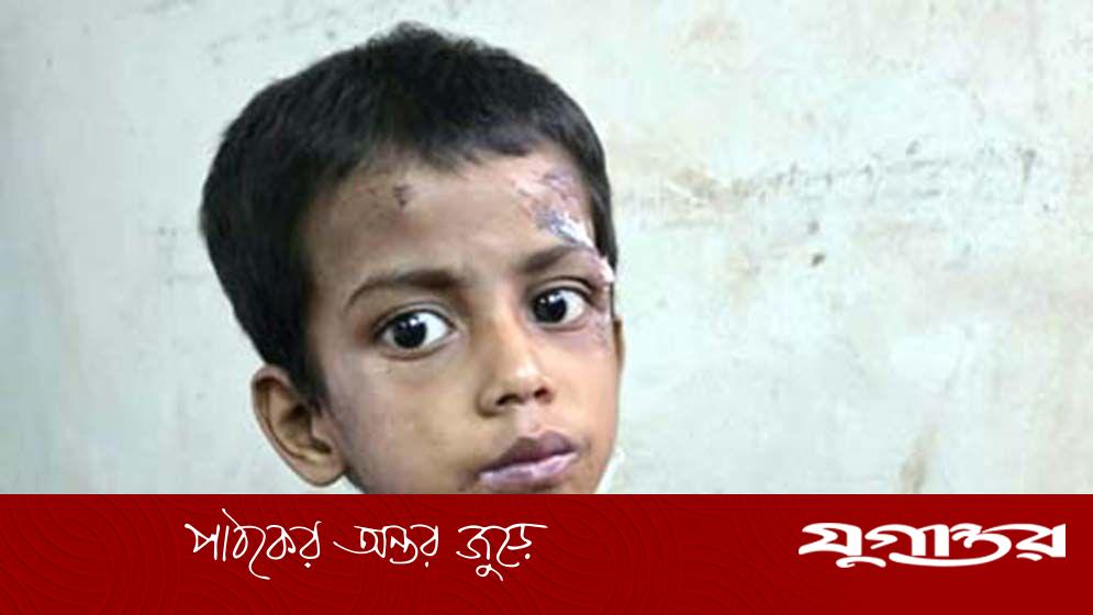 বাবার তালাবন্ধ ঘর থেকে রুগ্ন শিশু উদ্ধার