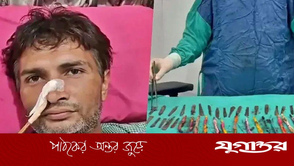 অস্ত্রোপচারে পেট থেকে বেরোল ২৯ চামচ, ১৯ টুথব্রাশ