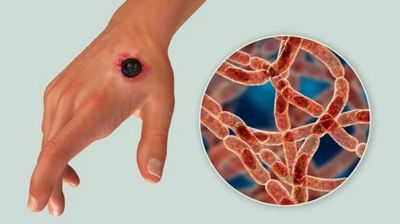 অ্যানথ্রাক্সে আতঙ্ক নয় সতর্ক থাকতে হবে