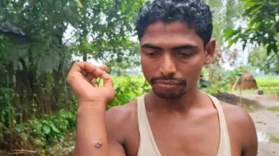 এক গ্রামের ১১ জনের শরীরে মিলল অ্যানথ্রাক্সের উপসর্গ