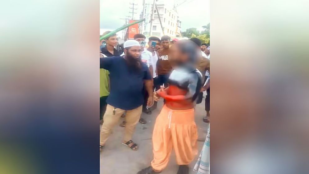 চুরির অপবাদে হোটেলকর্মীর চুল কেটে শরীরে পোড়া মবিল ঢেলে নির্যাতন