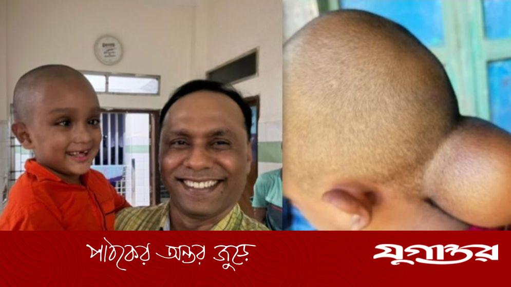 কায়সার কামালের হাত ধরে স্বাভাবিক জীবনে ফিরল শিশু রানা