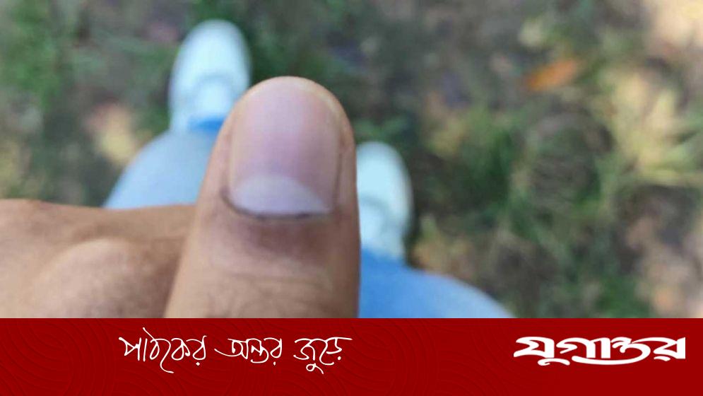 চাকসু নির্বাচন: মুছে যাচ্ছে আঙুলের কালি, অভিযোগ দেবে ছাত্রদল