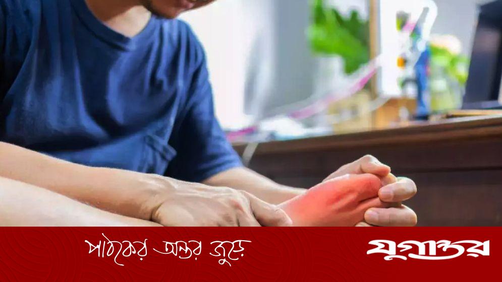 রক্তে ইউরিক অ্যাসিডের মাত্রা কমবে যে খাবারে