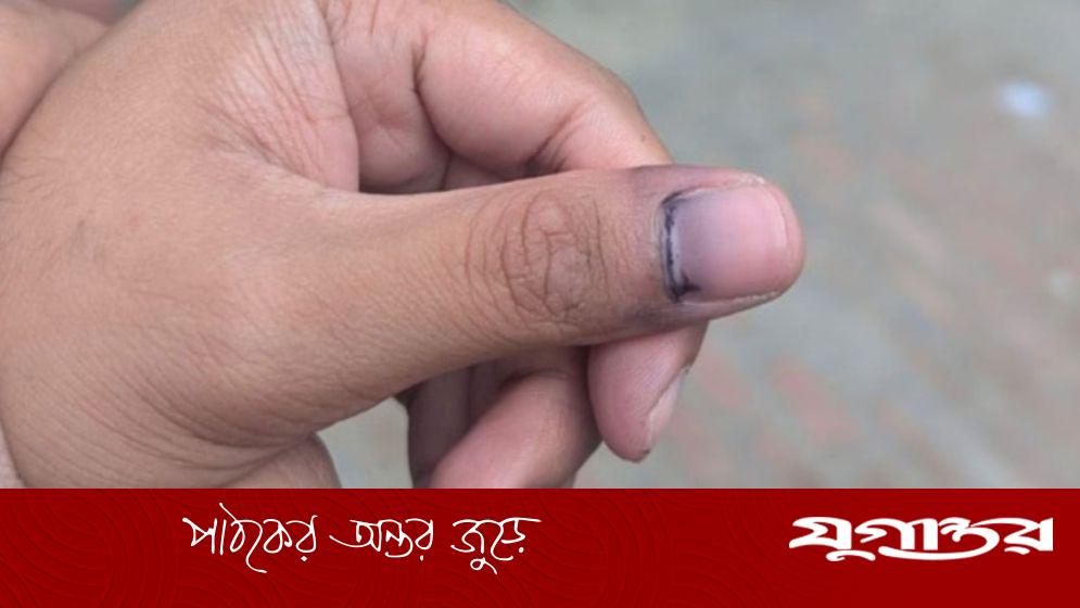 ঘষাঘষি না করে শুকানোর সময় দিন, কালি উঠবে না: রাবি উপাচার্য