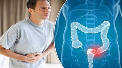 কোষ্ঠকাঠিন্য দূর করার সহজ কয়েকটি ঘরোয়া উপায়