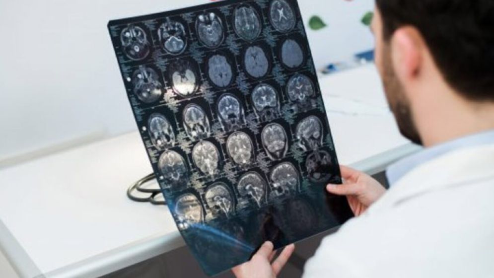 সব ব্রেন টিউমার মারাত্মক নয়