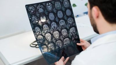 সব ব্রেন টিউমার মারাত্মক নয়