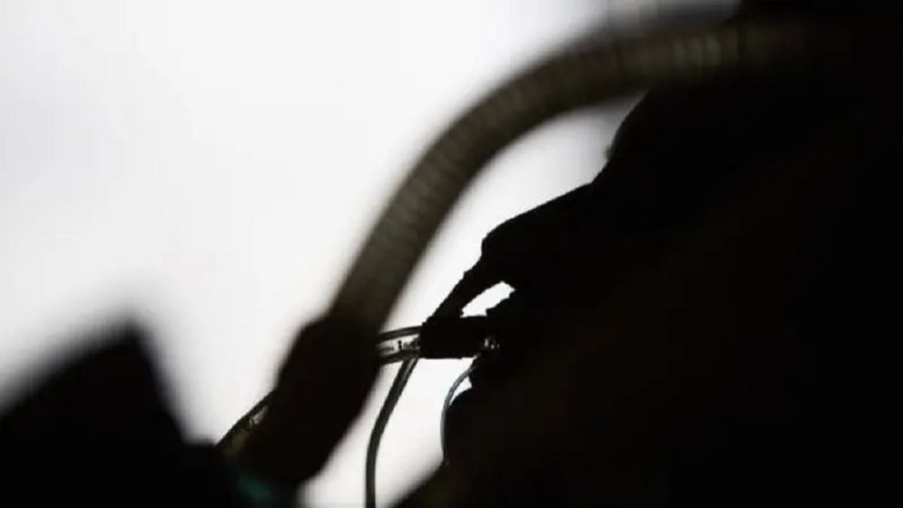 স্ট্রোকের মৃত্যু ঝুঁকি কমায় মেকানিক্যাল থ্রোম্বেক্টমি