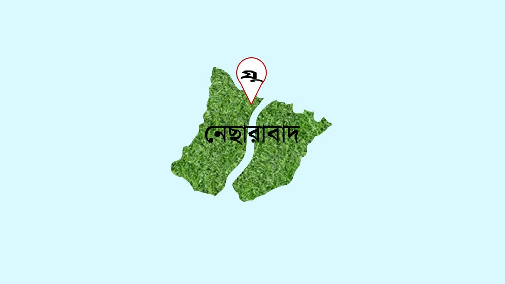 দুই মাথাওয়ালা শিশুর জন্ম