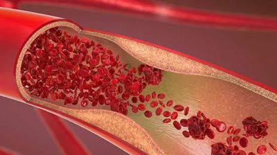 রক্ত জমাট না বাঁধার নীরব ঘাতক