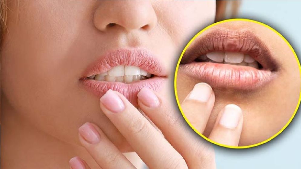ফেটে যাওয়া ঠোঁট যেসব টোটকায় হবে নরম ও মসৃণ