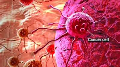 জেনে নিন কোন কোন অভ্যাস বাড়িয়ে তোলে ক্যানসারের ঝুঁকি