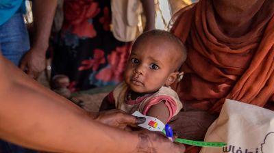 সুদানে অপুষ্টিতে ২৩ শিশুর মৃত্যু