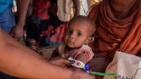 সুদানে অপুষ্টিতে ২৩ শিশুর মৃত্যু