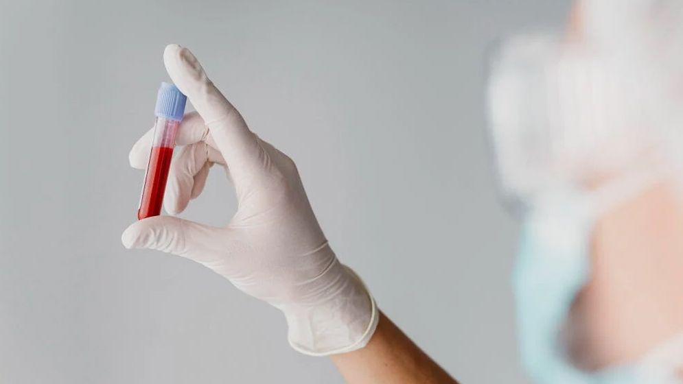 প্রতি ৬০ লাখে একজনের শরীরে থাকে ‘গোল্ডেন ব্লাড’