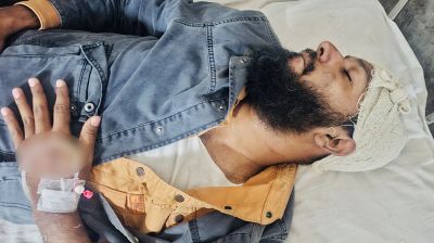 সাংবাদিককে হাতুড়ি দিয়ে পিটিয়ে আহত করলেন পুলিশ সদস্য