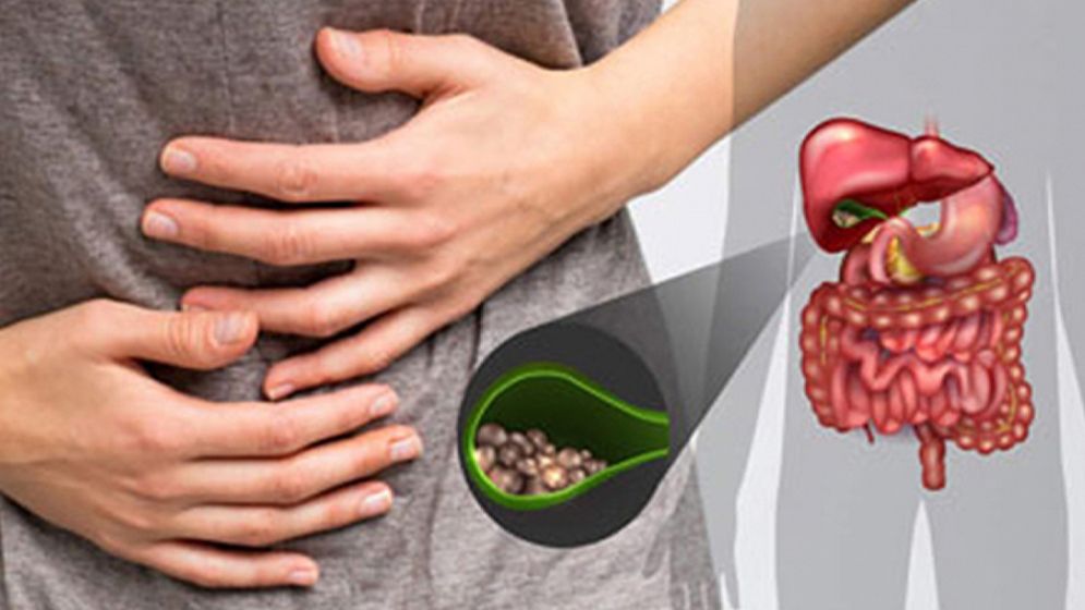 পিত্তথলির পাথর হওয়ার অন্যতম ৫ কারণ জানুন