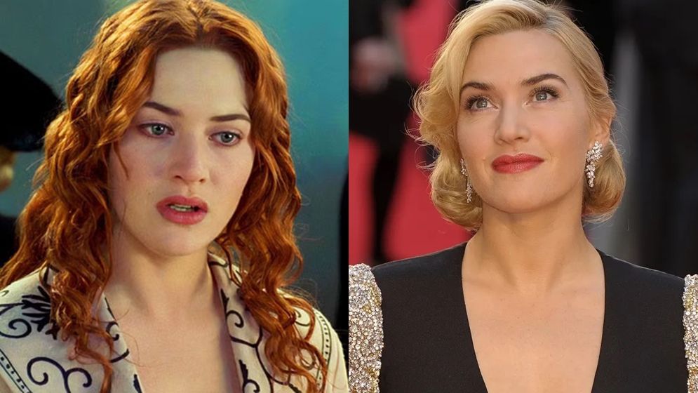 প্লাস্টিক সার্জারি নিয়ে যে কঠোর সমালোচনা করলেন কেট উইন্সলেট