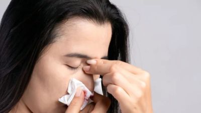 নাক দিয়ে রক্ত পড়া বন্ধে কী করবেন?