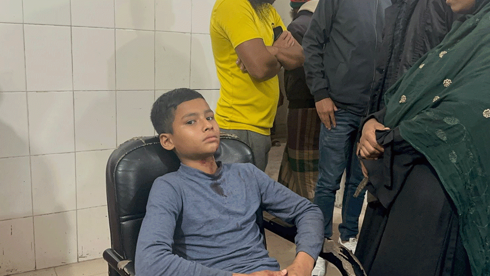 বাউফলে শিশু শ্রমিককে খুনতি দিয়ে পিটিয়ে জখম