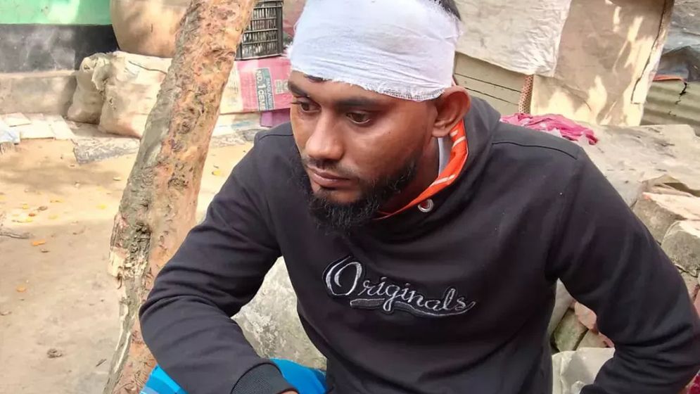 গিজার বিস্ফোরণে আহত ২