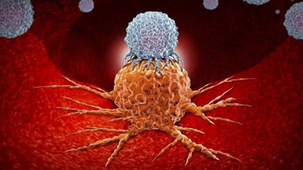 খাদ্য আঁশ ক্যানসার প্রতিরোধ করে